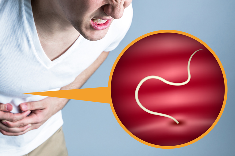 食後の激しい胃痛はアニサキス症の場合も…